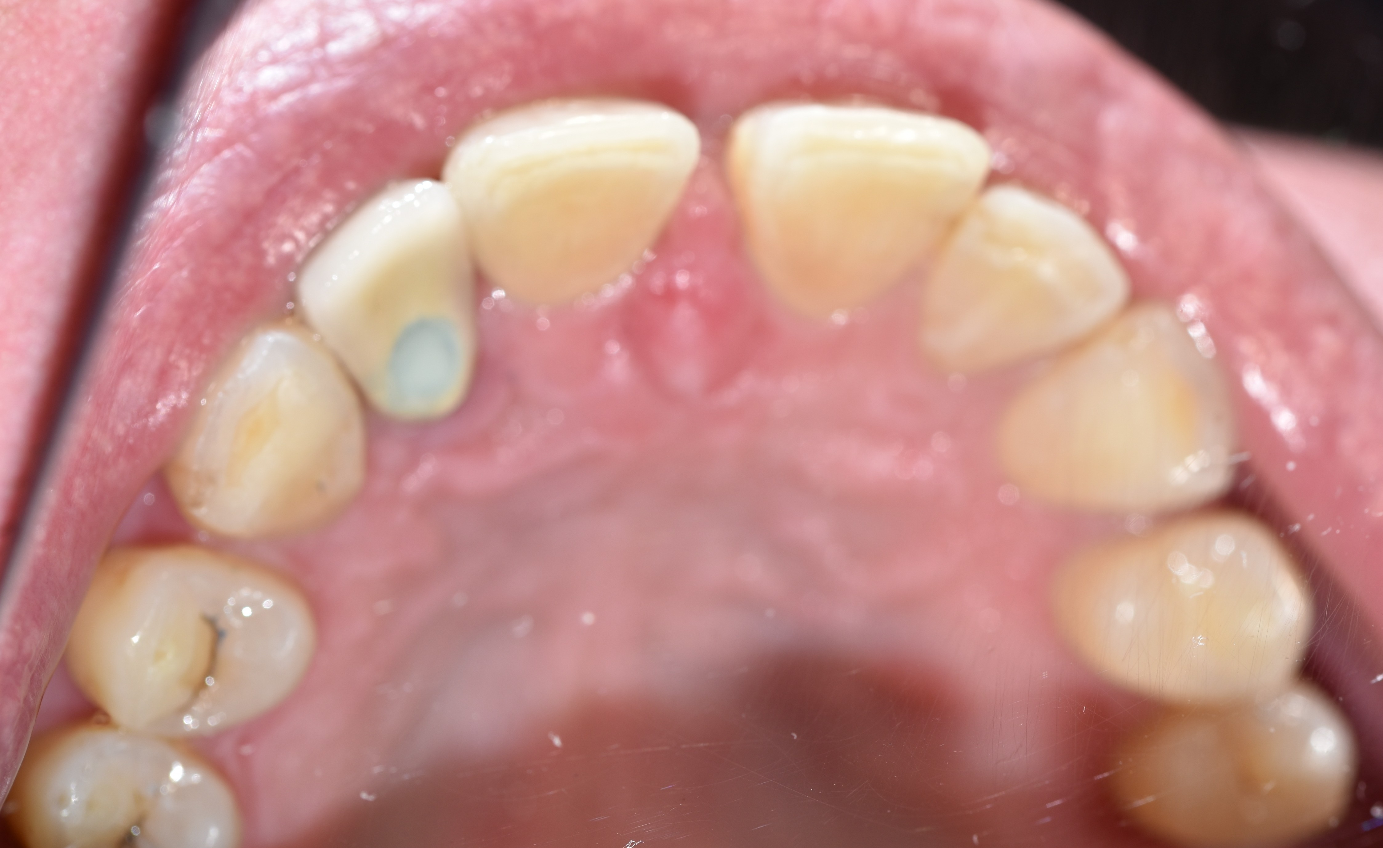 After treatment